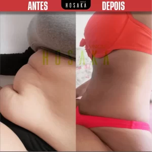 ANTES-E-DEPOIS-06