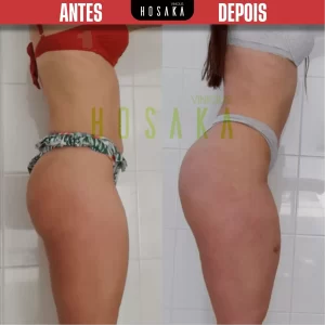 ANTES-E-DEPOIS-07