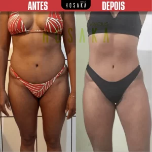 ANTES-E-DEPOIS-12