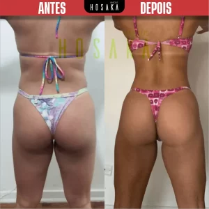 ANTES-E-DEPOIS-18