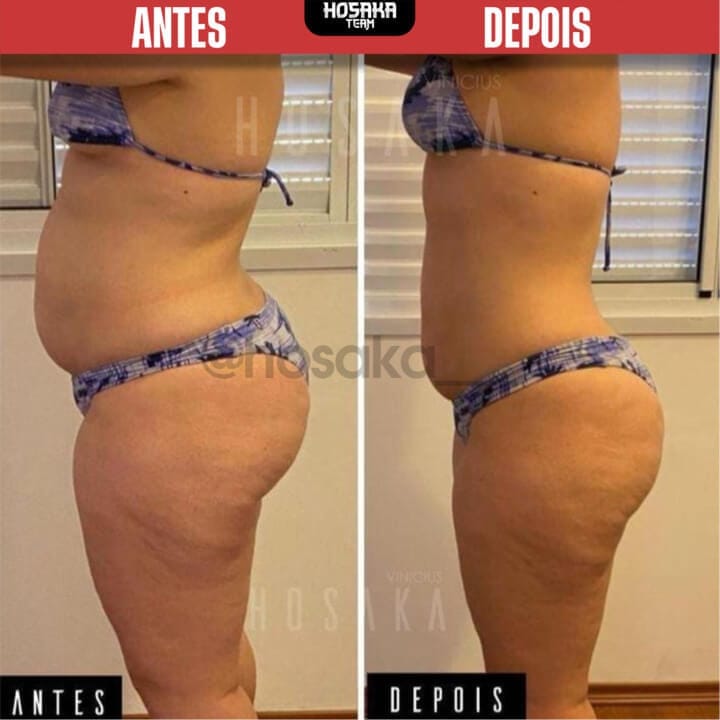 Cópia de Cópia de PROVAS - 19