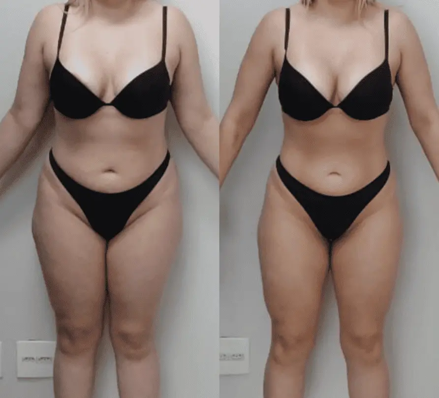 Depoimento Passo 3